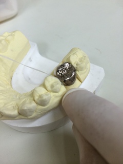 フロスを入れてみる