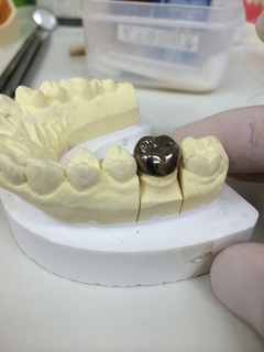 フロスを入れてみる