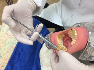 左下奥歯の麻酔ポジショニング