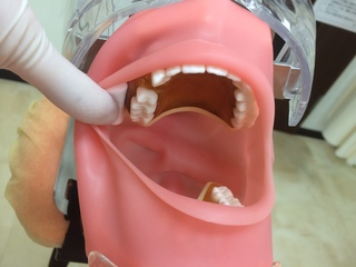 上顎の歯の防湿
