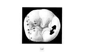 images-33676-thumbnail2.jpg