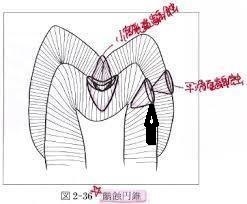 エナメル質も一緒に削らないと、ここの虫歯が取りきれない