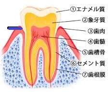 天蓋の位置はほとんどの場合、歯頸部付近にある